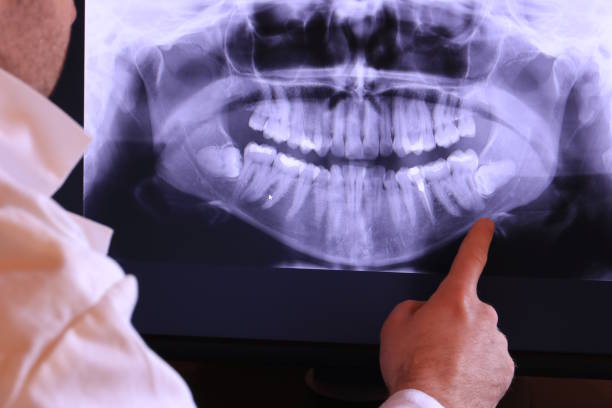 Best Emergency Dentist for Lost Fillings or Crowns in Parkersburg, IA